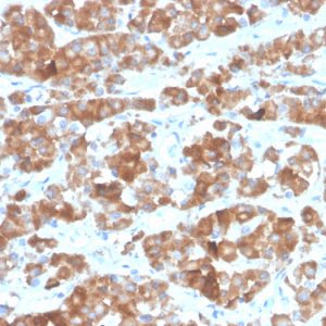 Formalin-fixed, paraffin-embedded human pituitary stained with LH-beta Recombinant Rabbit Monoclonal Antibody (LHb/1612R).