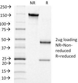 SDS-PAGE Analysis of Purified LHCGR Mouse Monoclonal Antibody (LHCGR/1415). Confirmation of Integrity and Purity of Antibody.