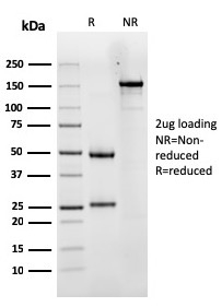 SDS-PAGE Analysis Purified LHCGR Mouse Monoclonal Antibody (LHCGR/1417). Confirmation of Integrity and Purity of Antibody
