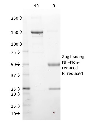 SDS-PAGE Analysis Purified LMO2 Mouse Monoclonal Antibody (LMO2/1971). Confirmation of Purity and Integrity of Antibody. LMO2 (B-Cell Marker) Antibody - Image 4