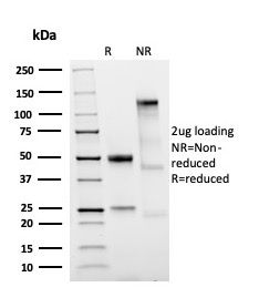 SDS-PAGE Analysis Purified LMO2 Recombinant Rabbit Monoclonal Antibody (LMO2/3147R). Confirmation of Purity and Integrity of Antibody.