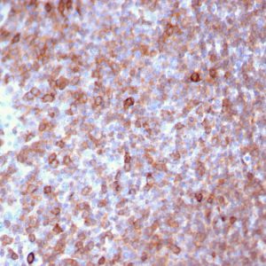 Formalin-fixed, paraffin-embedded human Lymph Node stained with Monospecific Mouse Monoclonal Antibody to LSP1 (LSP1/3025).