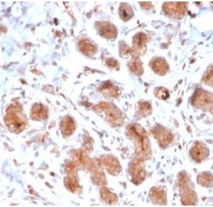 Formalin-fixed, paraffin-embedded human breaststained with Lactotransferrin Mouse Monoclonal Antibody (LTF/4073). HIER: Tris/EDTA, pH9.0, 45min. 2°C: HRP-polymer, 30min. DAB, 5min.