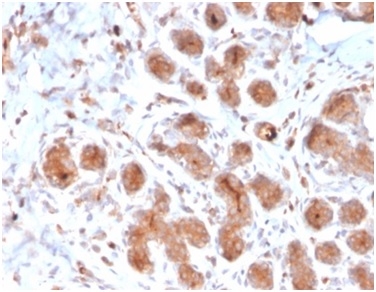 Formalin-fixed, paraffin-embedded human breaststained with Lactotransferrin Mouse Monoclonal Antibody (LTF/4073). HIER: Tris/EDTA, pH9.0, 45min. 2°C: HRP-polymer, 30min. DAB, 5min.