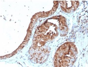 Formalin-fixed, paraffin-embedded human breaststained with Lactotransferrin Mouse Monoclonal Antibody (LTF/4079). HIER: Tris/EDTA, pH9.0, 45min. 2 °: HRP-polymer, 30min. DAB, 5min.