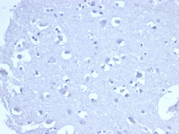IHC analysis of formalin-fixed, paraffin-embedded human brain. Negative tissue control using rTACSTD2/6395 at 2ug/ml in PBS for 30min RT. HIER: Tris/EDTA, pH9.0, 45min. 2°C: HRP-polymer, 30min. DAB, 5min.
