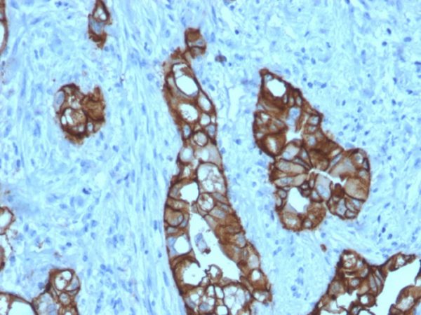 Formalin-fixed, paraffin-embedded human colon stained with TACSTD2 Recombinant Mouse Monoclonal Antibody (rTACSTD2/6397).