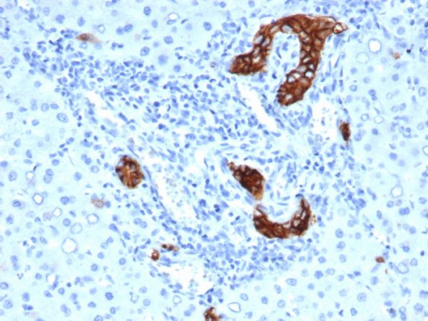Formalin-fixed, paraffin-embedded human liver in colon stained with TACSTD2 Recombinant Mouse Monoclonal Antibody (rTACSTD2/6397).