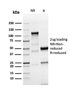 SDS-PAGE Analysis Purified TACSTD2 Recombinant Rabbit Monoclonal (TACSTD2/6396R). Confirmation of Purity and Integrity of Antibody.