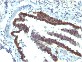 Formalin-fixed, paraffin-embedded rat lung stained with EpCAM Mouse Monoclonal Antibody (EGP40/1110).