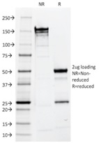SDS-PAGE Analysis Purified EpCAM Mouse Monoclonal Antibody (EGP40/1110). Confirmation of Purity and Integrity of Antibody.