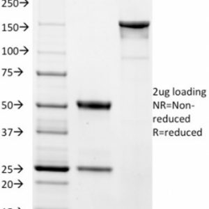 SDS-PAGE Analysis Purified EpCAM Mouse Monoclonal Antibody (EGP40/1384). Confirmation of Integrity and Purity of Antibody.