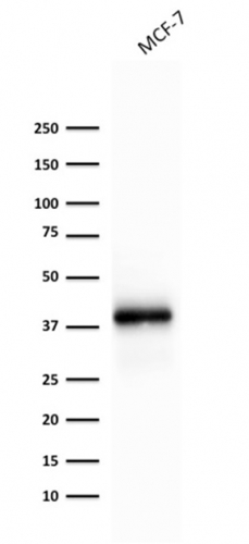 Western blot analysis of MCF-7 cell lysate using EpCAM Recombinant Mouse Monoclonal Antibody (rEGP40/1372).