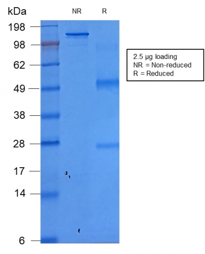 SDS-PAGE Analysis PurifiedEpCAM Recombinant Mouse Monoclonal Antibody (rEGP40/1372). Confirmation of Purity and Integrity of Antibody.