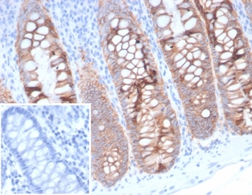 Formalin-fixed, paraffin-embedded human colon stained with EpCAM / CD326 Mouse Monoclonal Antibody (323/A3). Inset: PBS instead of primary antibody; secondary only negative control.