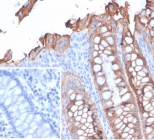 Formalin-fixed, paraffin-embedded human colon stained with EpCAM / CD326 Recombinant Mouse Monoclonal Antibody (rEGP40/7133). Inset: PBS instead of primary antibody; secondary only negative control.