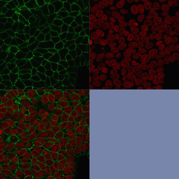 Immunofluorescence Analysis of MCF-7 cells labeling Ep-CAM with Ep-CAM Mouse Monoclonal Antibody (HEA125) followed by Goat anti-Mouse IgG-CF488 (Green). The nuclear counterstain is Reddot (Red)