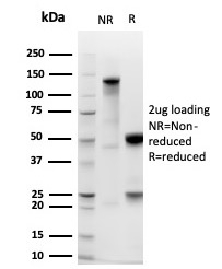 SDS-PAGE Analysis Purified EpCAM Recombinant Rabbit Monoclonal Antibody (EGP40/1555R). Confirmation of Integrity and Purity of Antibody.