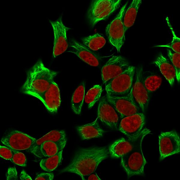Confocal immunofluorescence analysis of MeOH-fixed HeLa cells. EpCAM Recombinant Rabbit Monoclonal Antibody (EGP40/1555R) followed by goat anti-mouse IgG-CF488 (green). Nuclei counterstained with RedDot