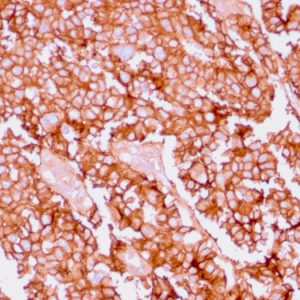 Formalin-fixed, paraffin-embedded human Ovary stained with EpCAM Rabbit Recombinant Monoclonal Antibody (EGP40/1556R).