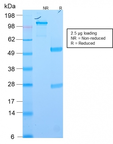 SDS-PAGE Analysis Purified EpCAM Rabbit Recombinant Monoclonal Antibody (EGP40/2571R). Confirmation of Integrity and Purity of Antibody.