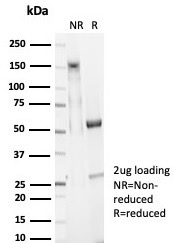 SDS-PAGE Analysis Purified EpCAM Rabbit Recombinant Monoclonal Antibody (EGP40/7025R). Confirmation of Integrity and Purity of Antibody.