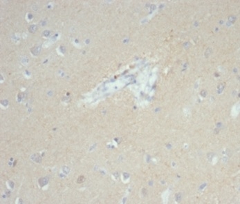 Formalin-fixed, paraffin-embedded human brain stained with EpCAM Rabbit Recombinant Monoclonal Antibody (EGP40/7035R). HIER: Tris/EDTA, pH9.0, 45min. 2°C: HRP-polymer, 30min. DAB, 5min.