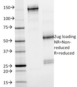 SDS-PAGE Analysis of Purified SMAD4 Mouse Monoclonal Antibody (SMAD4/2524). Confirmation of Purity and Integrity of Antibody.