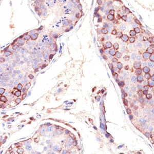 Formalin-fixed, paraffin-embedded human Testis stained with MAGE-1 Monoclonal Antibody (SPM282).