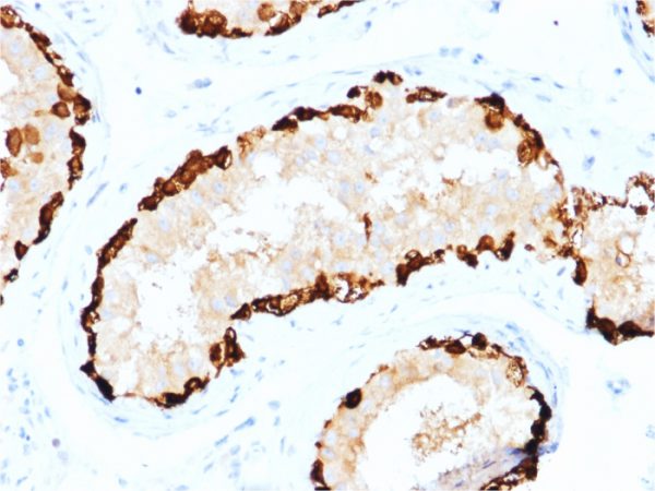 Formalin-fixed, paraffin-embedded human Testis stained with MAGEA4 Mouse Monoclonal Antibody (CPTC-MAGEA4-1).