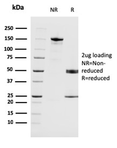 SDS-PAGE Analysis of Purified MAGEA4 Mouse Monoclonal Antibody (CPTC-MAGEA4-1). Confirmation of Purity and Integrity of Antibody.