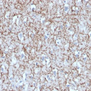 Formalin-fixed, paraffin-embedded human brain stained with Myelin Basic Protein Mouse Monoclonal Antibody (MBP/4272).