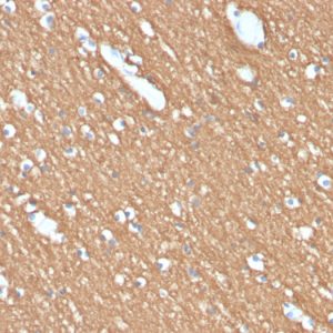 Formalin-fixed, paraffin-embedded human brain stained with Myelin Basic Protein Rat Monoclonal Antibody (MBP/4274).