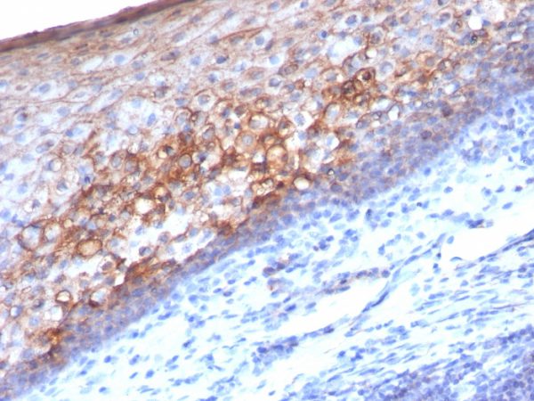 Formalin-fixed, paraffin-embedded human Tonsil stained with MCAM Mouse Monoclonal Antibody (MCAM/1101).