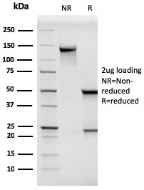 SDS-PAGE Analysis Purified MCAM Mouse Monoclonal Antibody (MCAM/3046). Confirmation of Purity and Integrity of Antibody.