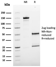 SDS-PAGE Analysis of Purified MCAM Mouse Monoclonal Antibody (MCAM/3179). Confirmation of Purity and Integrity of Antibody.