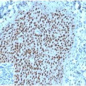 Formalin-fixed, paraffin-embedded human tonsil stained with MCM2 Mouse Monoclonal Antibody (MCM2/3678). Inset: PBS instead of primary antibody, secondary only control.
