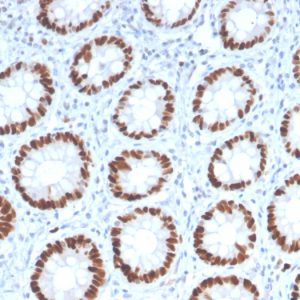 Formalin-fixed, paraffin-embedded human Colon stained with MCM6 Mouse Monoclonal Antibody (MCM6/2999).