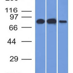 Western Blot Analysis A) HeLa (B) Raji and C) HepG2 cell lysate Using MCM7 Mouse Monoclonal Antibody (MCM7/1466).