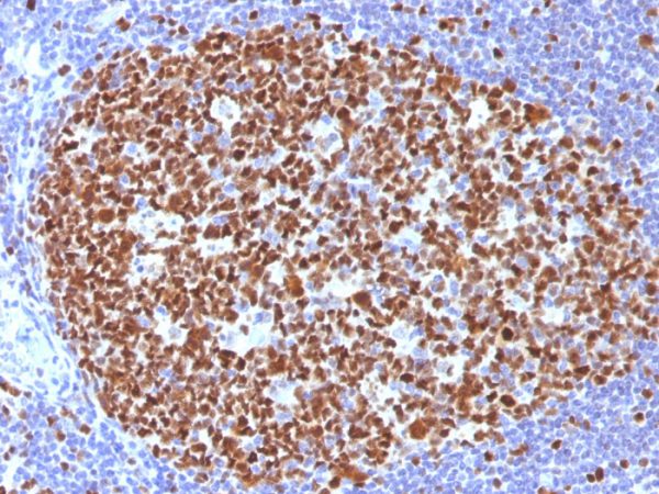 Formalin-fixed, paraffin-embedded human Tonsil stained with MCM7 Mouse Monoclonal Antibody (MCM7/1466).