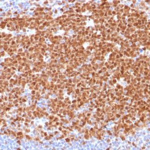 Formalin-fixed, paraffin-embedded human tonsil stained with MCM7 Mouse Monoclonal Antibody (MCM7/1468).