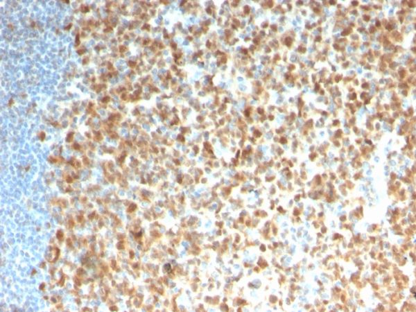 Formalin-fixed, paraffin-embedded human Tonsil stained with MCM7 Recombinant Mouse Monoclonal Antibody (rMCM7/1468).