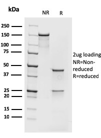 SDS-PAGE Analysis Purified MCM7 Recombinant Mouse Monoclonal Antibody (rMCM7/1468). Confirmation of Integrity and Purity of Antibody.