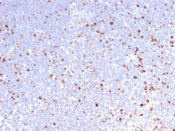 Formalin-fixed, paraffin-embedded human Lymph Node stained with MCM7 Rabbit Recombinant Monoclonal Antibody (MCM7/2832R).