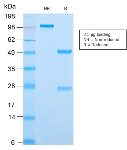 SDS-PAGE Analysis Purified MCM7 Rabbit Recombinant Monoclonal Antibody (MCM7/2832R). Confirmation of Purity and Integrity of Antibody.