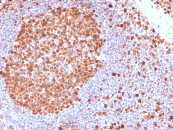 Formalin-fixed, paraffin-embedded human Tonsil stained with MCM7 Rabbit Recombinant Monoclonal Antibody (MCM7/2832R).