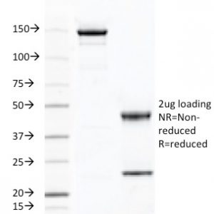 SDS-PAGE Analysis of Purified CD46 Mouse Monoclonal Antibody (169-1-E4.3). Confirmation of Integrity and Purity of Antibody