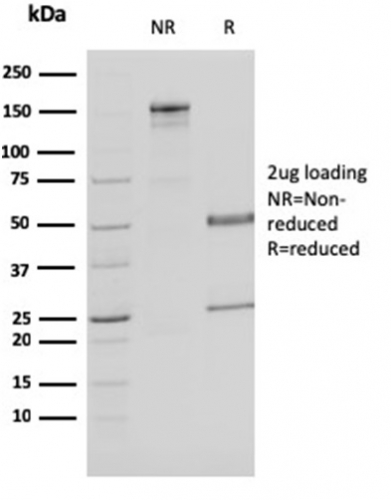SDS-PAGE Analysis Purified MDH1 Mouse Monoclonal Antibody (CPTC-MDH1-1). Confirmation of Purity and Integrity of Antibody.