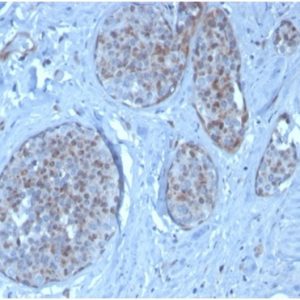 Formalin-fixed, paraffin-embedded human pancreas stained with MDM2 Mouse Monoclonal Antibody (MDM2/3277). HIER: Tris/EDTA, pH9.0, 45min. 2°C: HRP-polymer, 30min. DAB, 5min.