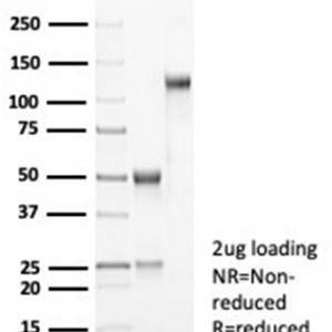 SDS-PAGE Analysis of Purified MDM2 Recombinant Rabbit Monoclonal Antibody (MDM2/7061R). Confirmation of Purity and Integrity of Antibody.